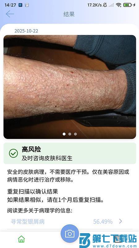 医用皮肤镜影像处理 v1.0.0 安卓版 3